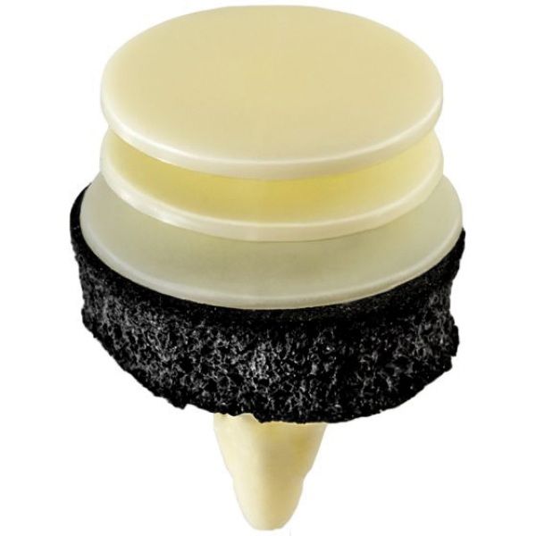 Auveco 19428 Trim Panel Retainer, (18 mm Dia Top x 20 mm Dia Bottom) Head x (8 mm Dia x 19 mm L) Ste